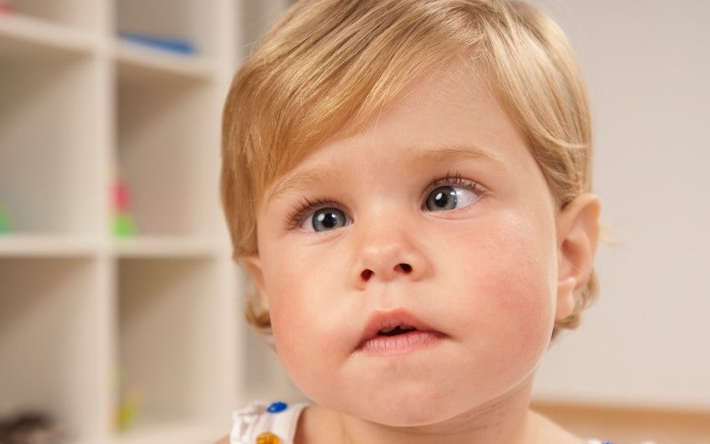 Oftalmólogos pediátrica en Margarita - Estrabismo en Margarita Oftalmólogos pediátrica en Margarita - Estrabismo en Margarita